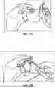 Fig. 13 - GLENOID REPLACEMENT SYSTEM AND METHODS OF IMPLANTING SAID GLENOID REPLACEMENT