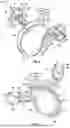 Fig. 06 - GLENOID REPLACEMENT SYSTEM AND METHODS OF IMPLANTING SAID GLENOID REPLACEMENT