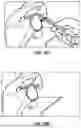 Fig. 12 - GLENOID REPLACEMENT SYSTEM AND METHODS OF IMPLANTING SAID GLENOID REPLACEMENT