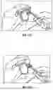 Fig. 14 - GLENOID REPLACEMENT SYSTEM AND METHODS OF IMPLANTING SAID GLENOID REPLACEMENT