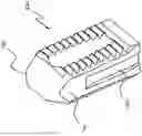 Fig. 01 - Method of forming and decorticating a void in a sacroiliac joint
