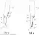 Fig. 06 - Method of forming and decorticating a void in a sacroiliac joint
