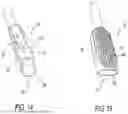 Fig. 11 - Method of forming and decorticating a void in a sacroiliac joint