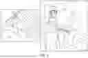 Fig. 02 - Implant delivery device