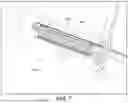 Fig. 08 - Implant delivery device