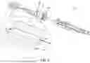Fig. 10 - Implant delivery device