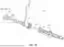 Fig. 11 - Implant delivery device
