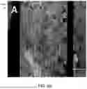 Fig. 10 - MONOLAYER CELL PATCH IN AN EXTRACELLULAR MATRIX SCAFFOLD