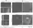 Fig. 15 - MONOLAYER CELL PATCH IN AN EXTRACELLULAR MATRIX SCAFFOLD