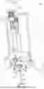 Fig. 02 - Vent tube for bottling machine and related methods