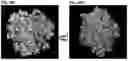 Fig. 11 - Desmoglein 2 (DSG2) Binding Proteins and Uses Therefor