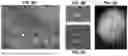 Fig. 15 - Desmoglein 2 (DSG2) Binding Proteins and Uses Therefor