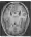 Fig. 01 - SYSTEMS AND METHODS FOR ORGAN SHAPE ANALYSIS FOR DISEASE DIAGNOSIS AND RISK ASSESSMENT