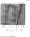 Fig. 04 - SYSTEMS AND METHODS FOR ORGAN SHAPE ANALYSIS FOR DISEASE DIAGNOSIS AND RISK ASSESSMENT