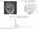 Fig. 07 - SYSTEMS AND METHODS FOR ORGAN SHAPE ANALYSIS FOR DISEASE DIAGNOSIS AND RISK ASSESSMENT
