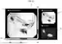 Fig. 07 - ENDOSCOPIC EXAMINATION SUPPORT APPARATUS, ENDOSCOPIC EXAMINATION SUPPORT METHOD, AND RECORDING MEDIUM