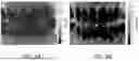 Fig. 09 - Intraoral Diagnostic Device and Method of Using Same