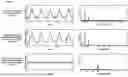 Fig. 09 - APPARATUS AND METHOD OF NONINVASIVELY AND SEPARATELY MEASURING LUNG VENTILATION AND CARDIAC BLOOD FLOW COMPONENTS