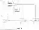 Fig. 02 - Devices and methods for determining blood flow around a body lumen
