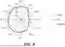 Fig. 08 - Devices and methods for determining blood flow around a body lumen
