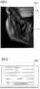 Fig. 04 - Anatomy Masking for MRI