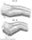 Fig. 08 - PREOPERATIVE METHOD AND SYSTEM FOR MINIMIZING WOUND COMPLICATIONS