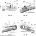 Fig. 08 - IMPLANT DEVICE, SYSTEM AND METHOD