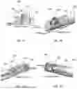 Fig. 09 - IMPLANT DEVICE, SYSTEM AND METHOD