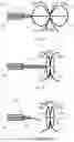 Fig. 09 - LONGITUDINALLY COMPRESSIBLE VASCULAR OCCLUDER