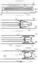 Fig. 12 - LONGITUDINALLY COMPRESSIBLE VASCULAR OCCLUDER