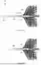 Fig. 16 - LONGITUDINALLY COMPRESSIBLE VASCULAR OCCLUDER