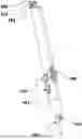 Fig. 01 - ELECTROSURGICAL DEVICE WITH A DEPLOYABLE ELECTRODE TIP AND INTEGRATED MODULATED SMOKE EVACUATION AND SUCTION CONTROL