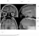 Fig. 02 - SYSTEM AND METHOD FOR MINIMALLY INVASIVE SURGICAL INTERVENTIONS