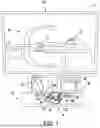 Fig. 02 - ROBOTIC CATHETER SYSTEM WITH VARIABLE DRIVE MECHANISM