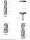 Fig. 02 - METHOD AND APPARATUS FOR SURGICAL DRILL STOP PLACEMENT