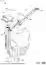 Fig. 72 - SURGICAL EQUIPMENT HOLDER