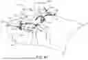 Fig. 77 - SURGICAL EQUIPMENT HOLDER