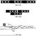 Fig. 08 - SYSTEM, APPARATUS AND METHODS FOR RECOGNIZING SURGICAL ARTICLES LEFT INSIDE PATIENTS