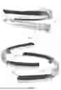 Fig. 02 - ORTHODONTIC ALIGNER COMPRISING BITE PLATE