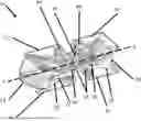 Fig. 01 - Stationary Wedge Expandable Interbody Device