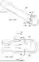 Fig. 15 - SYSTEMS AND METHODS FOR TEMPERATURE CONTROL IN DELIVERY OF THERMAL LIQUID TREATMENT