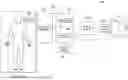 Fig. 17 - SYSTEMS AND METHODS FOR TEMPERATURE CONTROL IN DELIVERY OF THERMAL LIQUID TREATMENT
