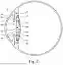 Fig. 07 - APPARATUS AND METHOD FOR LENS SURGERY