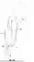 Fig. 16 - APPARATUS AND METHOD FOR PROTECTING POST-AMPUTATION RESIDUUM
