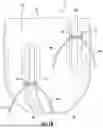 Fig. 21 - APPARATUS AND METHOD FOR PROTECTING POST-AMPUTATION RESIDUUM