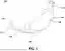 Fig. 02 - MULTI-MATERIAL GOLF CLUB HEAD