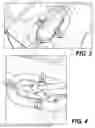 Fig. 04 - Pedal drive and steering assembly for inflatable watercraft and watercraft combined with same