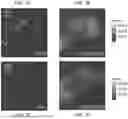 Fig. 08 - METHOD FOR TRANSPOSASE MEDIATED SPATIAL TAGGING AND ANALYZING GENOMIC DNA IN A BIOLOGICAL SAMPLE