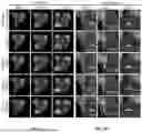 Fig. 08 - SYSTEMS AND METHODS FOR MAGNETIC RESONANCE IMAGE RECONSTRUCTION WITH DENOISING