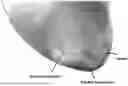 Fig. 01 - Detection and characterization of cancerous tumors